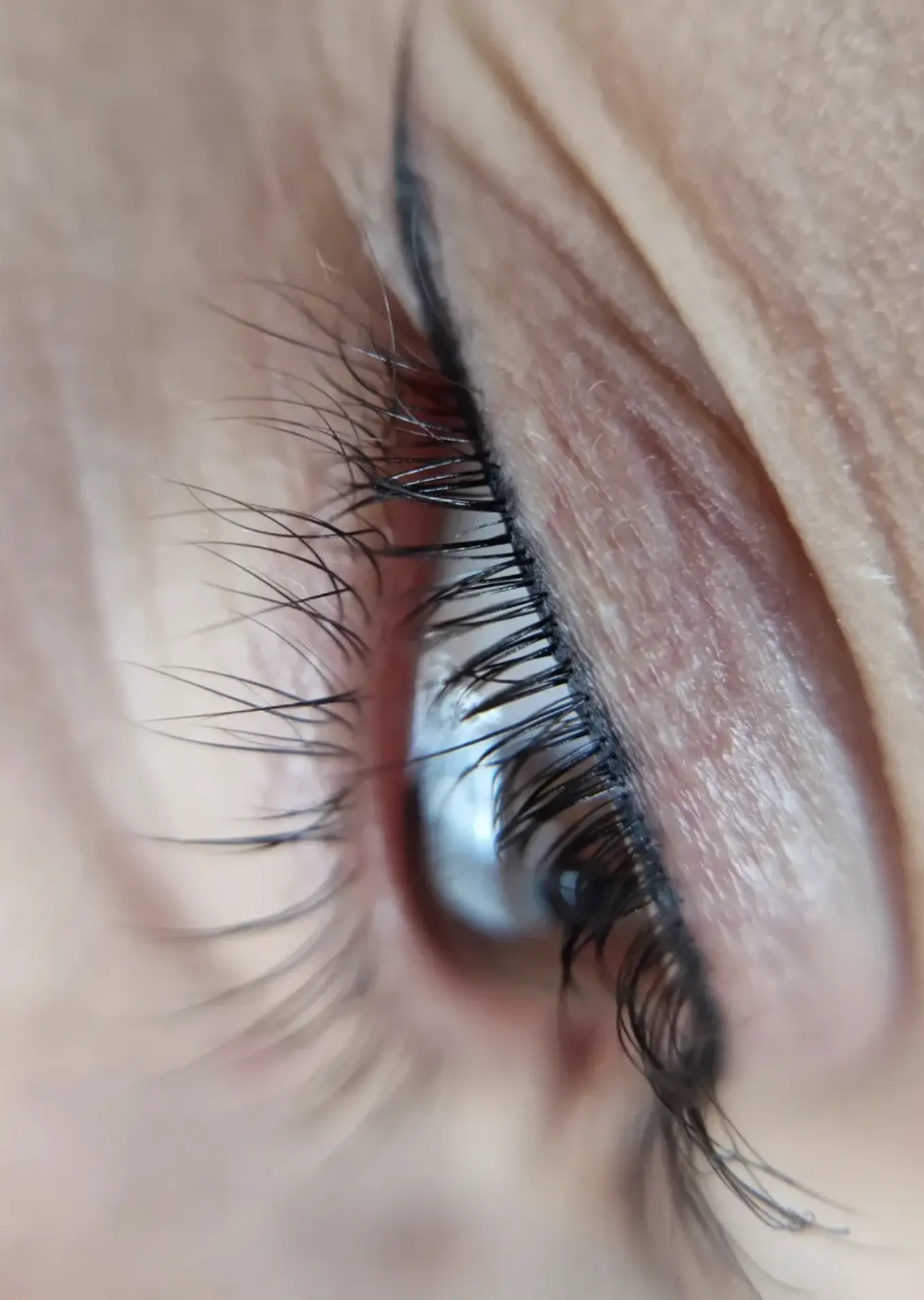 Permanent eyeliner healing